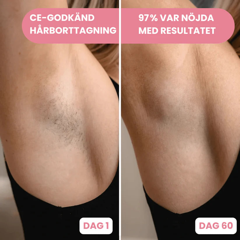 Lumina IPL™ – Avanceret IPL til hjemmebrug