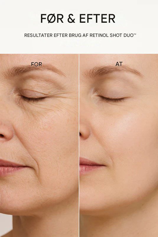 NovaMax™ Retinol Shot- strålende hudpositionering.