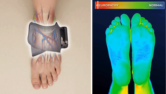NovaRelief™ - 3-i-1 Fodterapi-Massager – Varme, Massage & Kompression mod smerter
