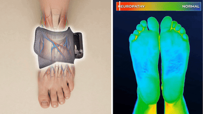 NovaRelief™ - 3-i-1 Fodterapi-Massager – Varme, Massage & Kompression mod smerter