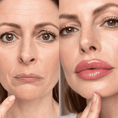 LipLift™ – Fyldige, bløde og kysseklar læber på 24 timer – helt naturligt