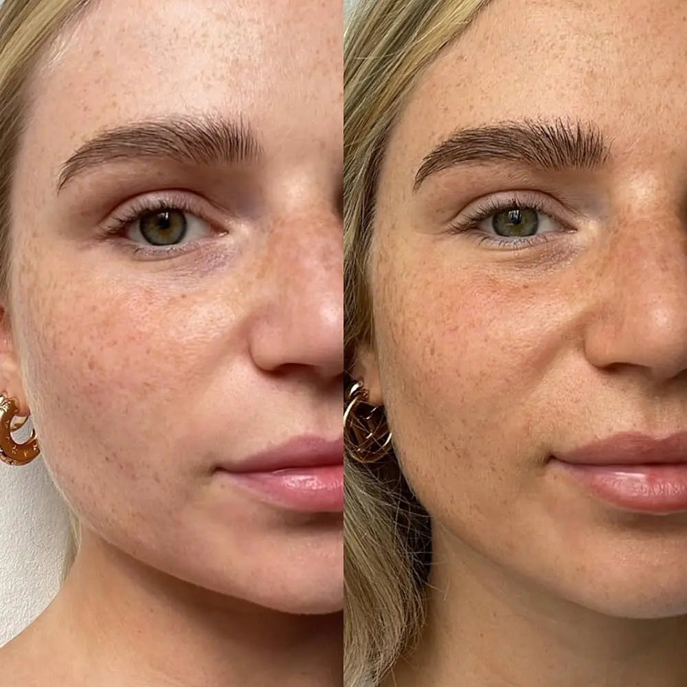 SunGlow™ – Naturlig glød uden solen