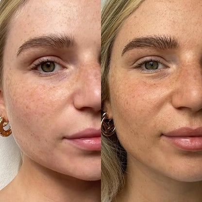 SunGlow™ – Naturlig glød uden solen