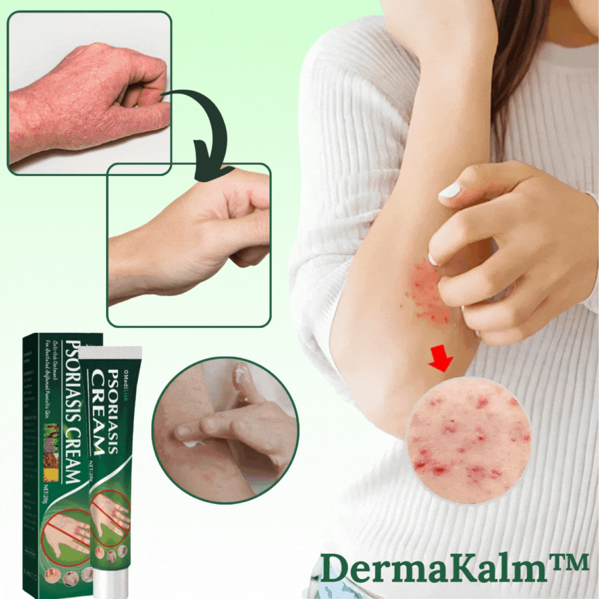 DermaKalm™ | Stop eksem og genopret sund hud på kun 2 dage