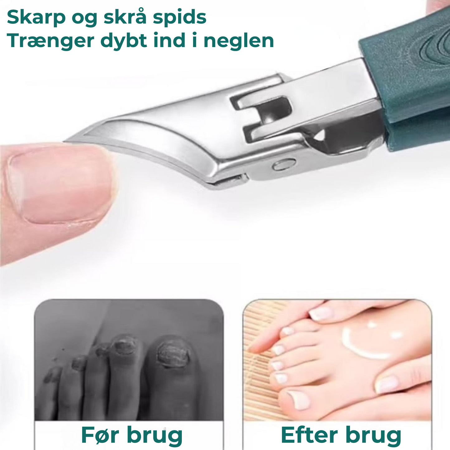 Nova Clip™ - Selv til de mest følsomme negle