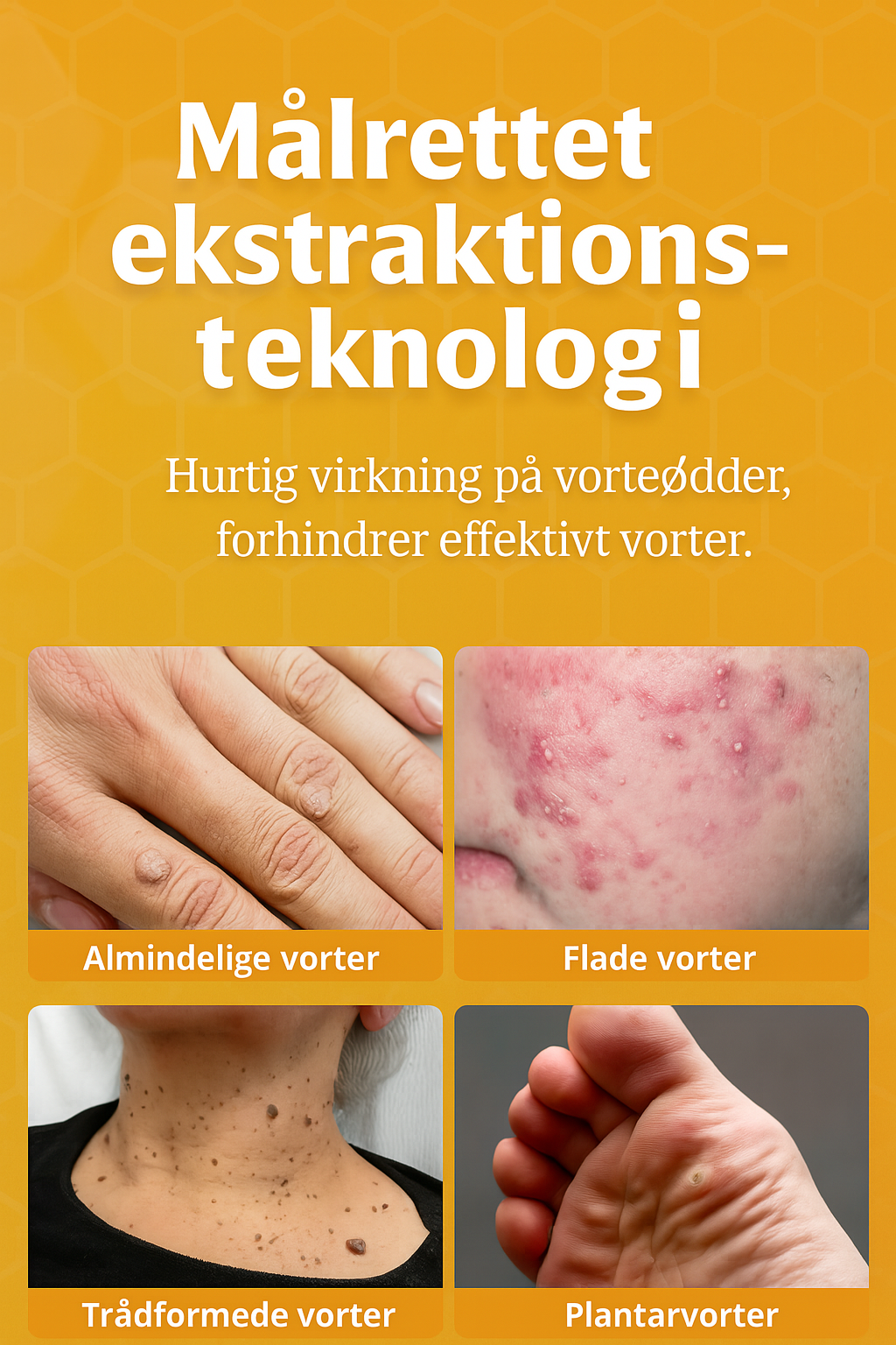 NovaBee™ – Fjern vorter og hudproblemer naturligt på 1–2 uger