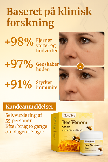 NovaBee™ – Fjern vorter og hudproblemer naturligt på 1–2 uger