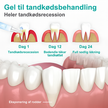 Teeth Repair Gel™ | Stop blødende tandkød, styrk tænderne – mærk lindring på helt ned til 7 dage