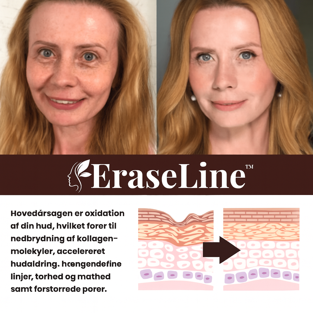 EraseLine™ | Glat rynker på 7 dage – få yngre, fastere hud uden Botox