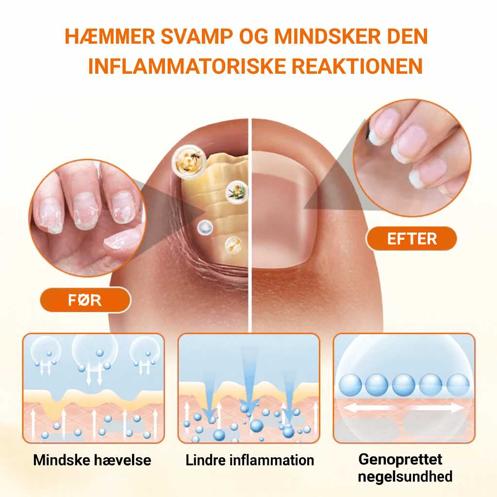 Nagelfrid™ | 99 % af neglesvamp væk på kun 7 dage – få rene, stærke og smukke negle igen