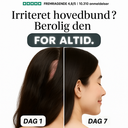 NovaCalm™ – Naturlig lindring for kløende, rød og sensitiv hud