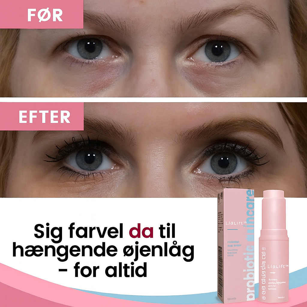 LidLift™ – Øjeblikkelig Øjenløftende Creme