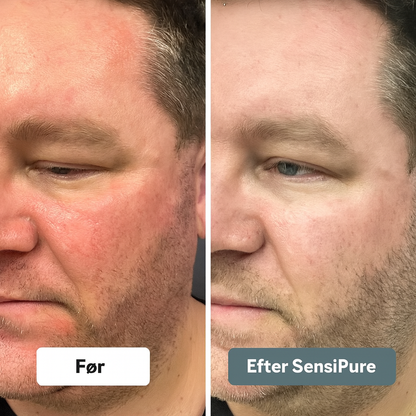SensiPure™ – Naturlig lindring för känslig hud
