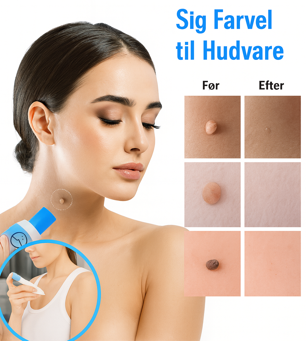 Nova Remover™ Kit – Fjern hudflapper sikkert og nemt derhjemme