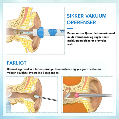 Aurix™ – Skånsom Ørerens på Kun 60 Sekunder