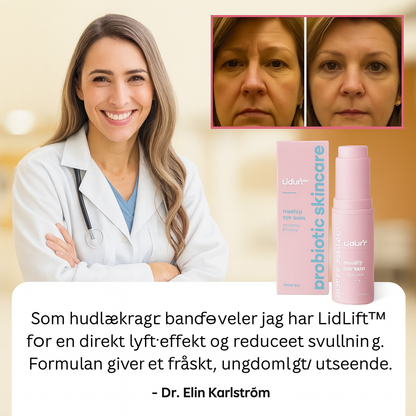 LidLift™ – Øjeblikkelig Øjenløftende Creme