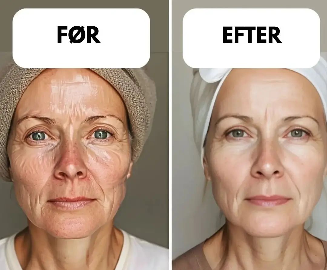 GreenMadame™ – Rindertalg & Honning Balsam