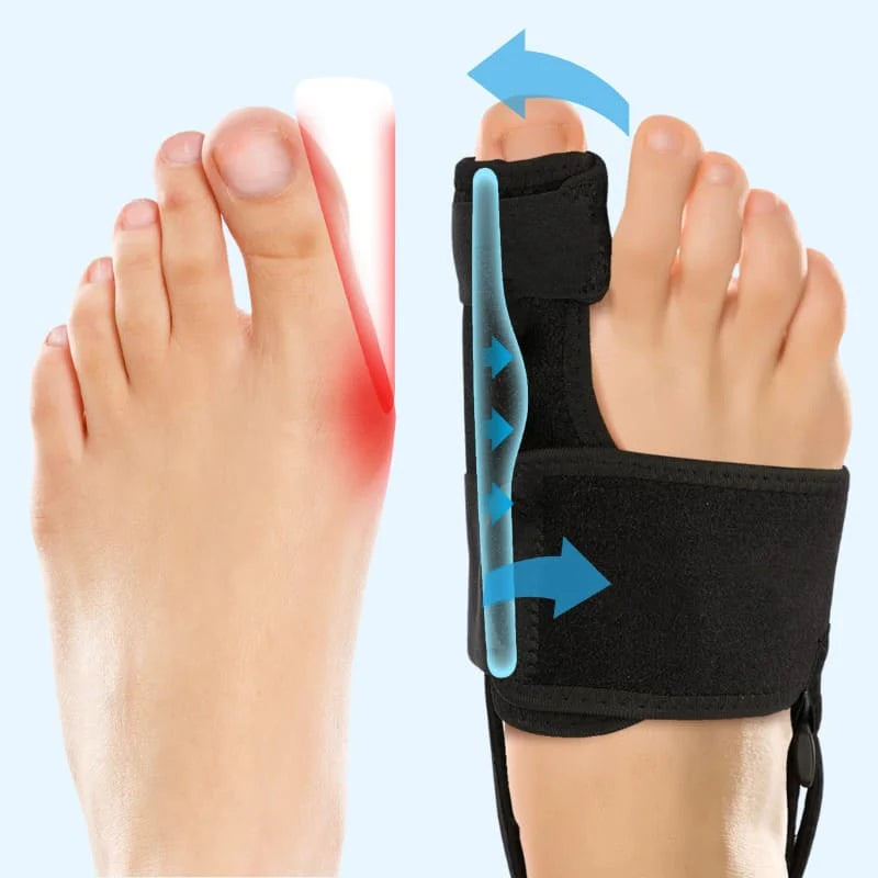 Valgux™ Braces | Daglig Støtte til Storetåens Position & Behagelig Bevægelse