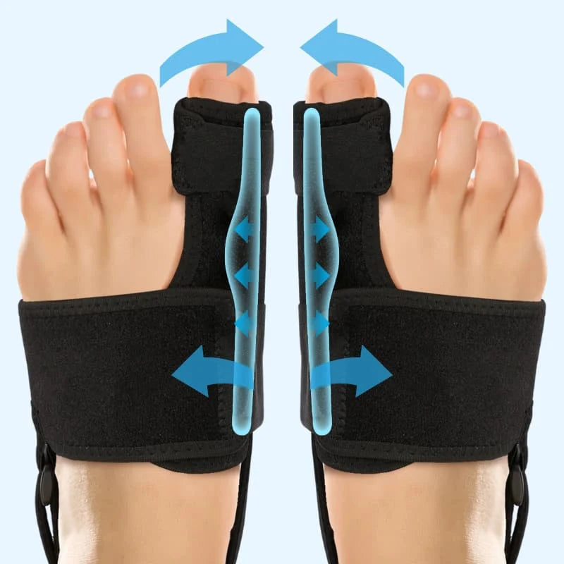 Valgux™ Braces | Daglig Støtte til Storetåens Position & Behagelig Bevægelse