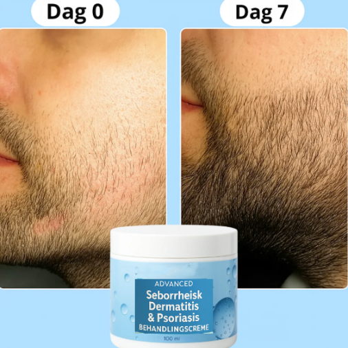 NovaBeard™ - For tykkere, fyldigere skæg
