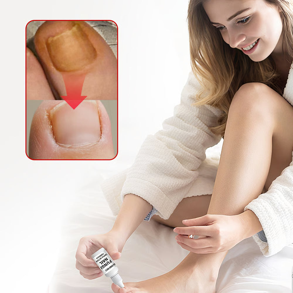 FungoNail™ | Hurtig, Naturlig Lindring mod Neglesvamp – Synlige Resultater på 2–4 Uger