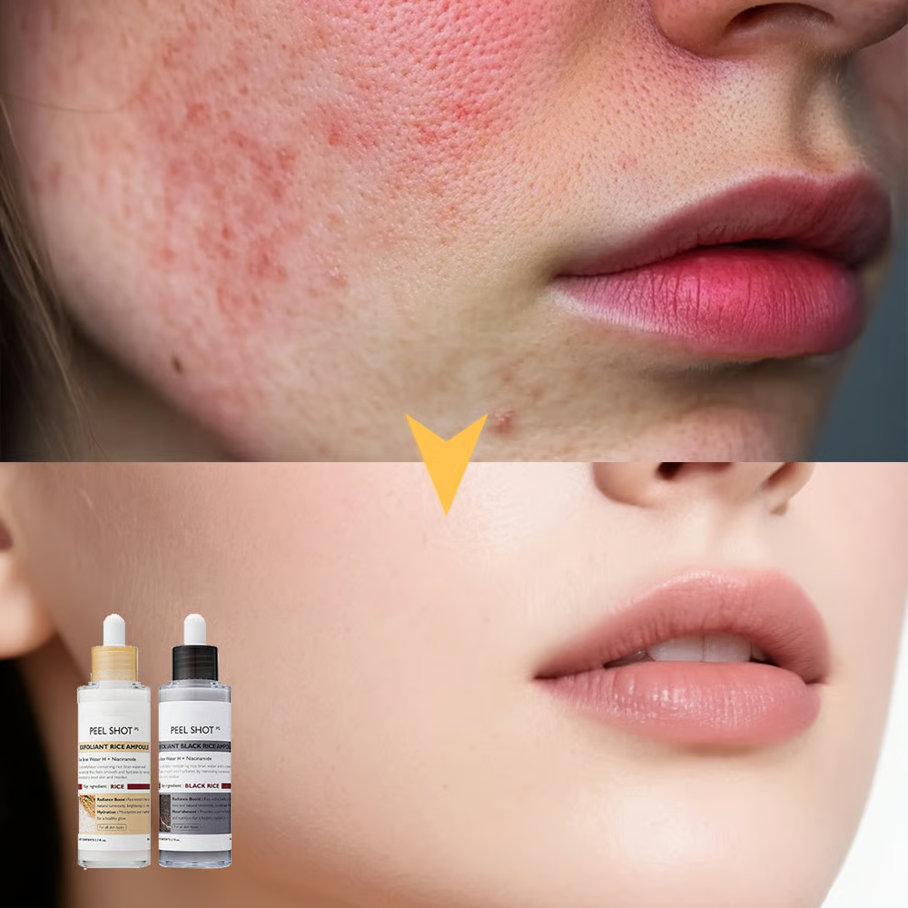 Nova Gentle Glow – Sort Ris