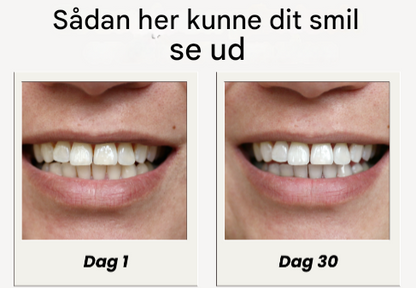 NovaSmile™ SmartBrush – Automatisk tandbørste til tandblegning