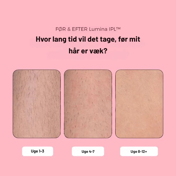 Lumina IPL™ – Avanceret IPL til hjemmebrug