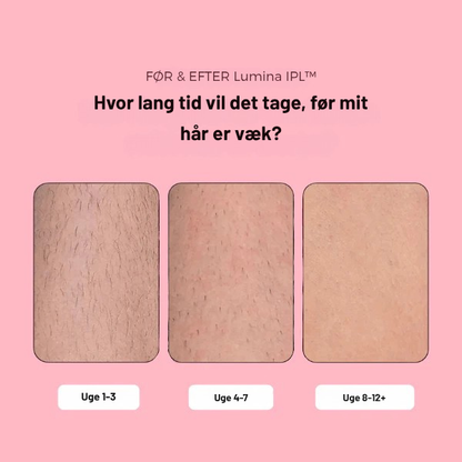 Lumina IPL™ – Avanceret IPL til hjemmebrug